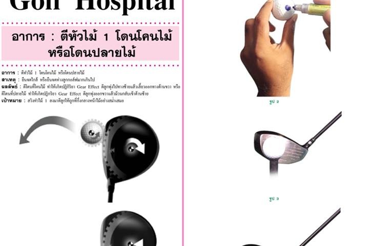 Golf-Hospital อาการ : ตีหัวไม้ 1 โดนโคนไม้ หรือโดนปลายไม้